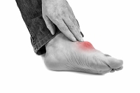 What Causes Gout?