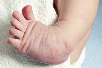 Common Congenital Foot Abnormalities